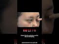 谨慎黑眼球的露出度Avoid over-exposing the iris#眼睛 #双眼皮 #眼袋  #医美