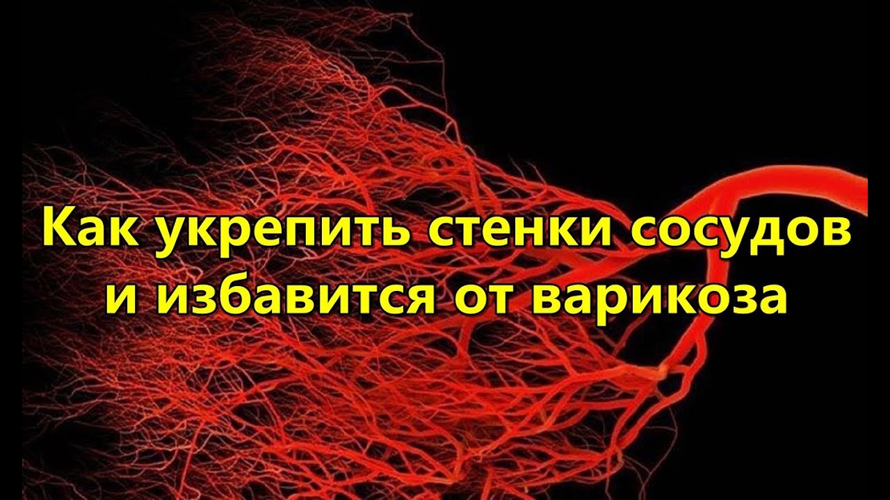 Восстановить сосуды после. Укрепление кровеносных сосудов. Что укрепляет стенки сосудов. Для поддержания сосудов. Укрепление стенок сосудов.