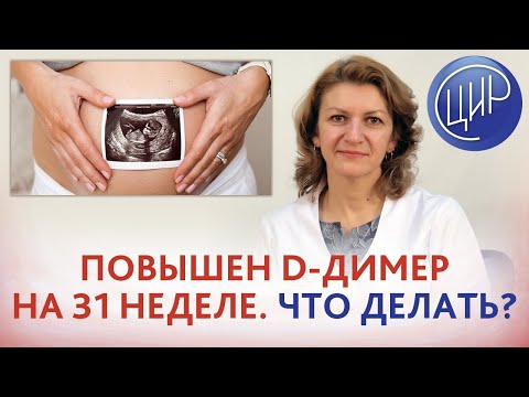 Повышен D-димер при нормальной коагулограмме на 31 неделе беременности. В чём причина и что делать?