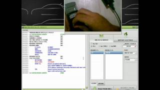 LG GB130 read code by microbox