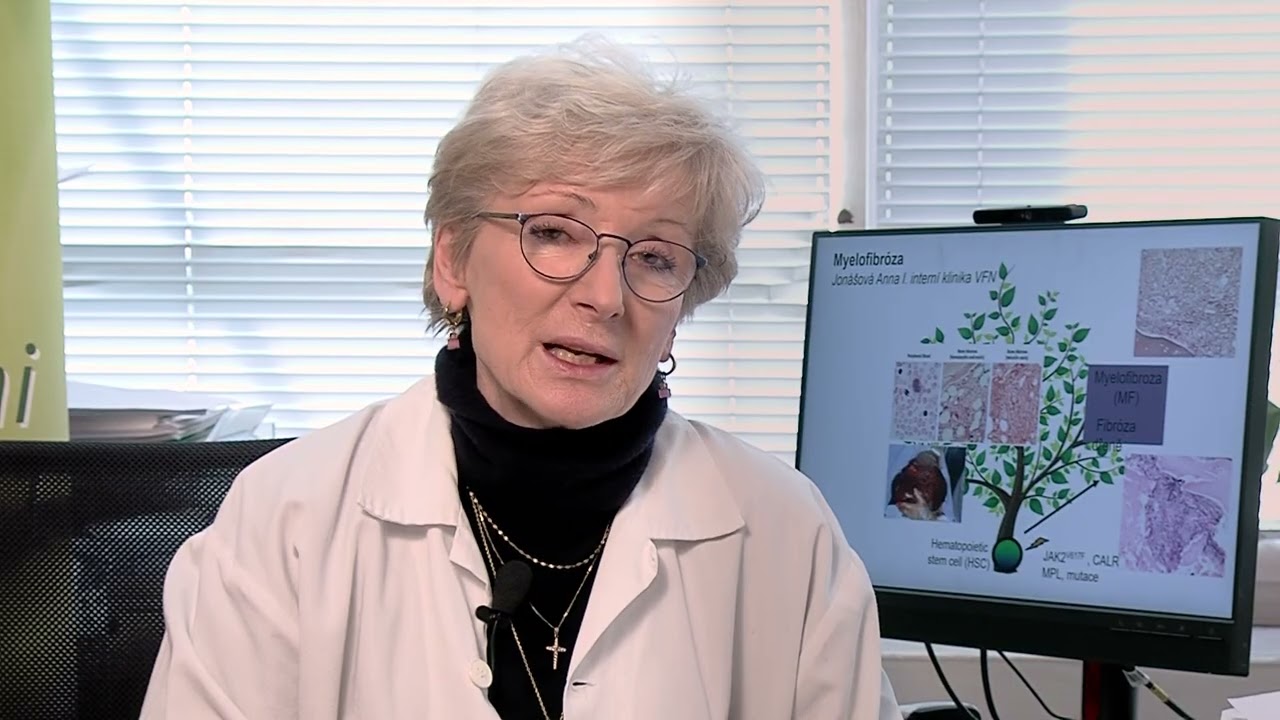 01. Co je a jak se projevuje myelofibróza