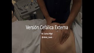 External Cephalic Version - Dr. Piñel
