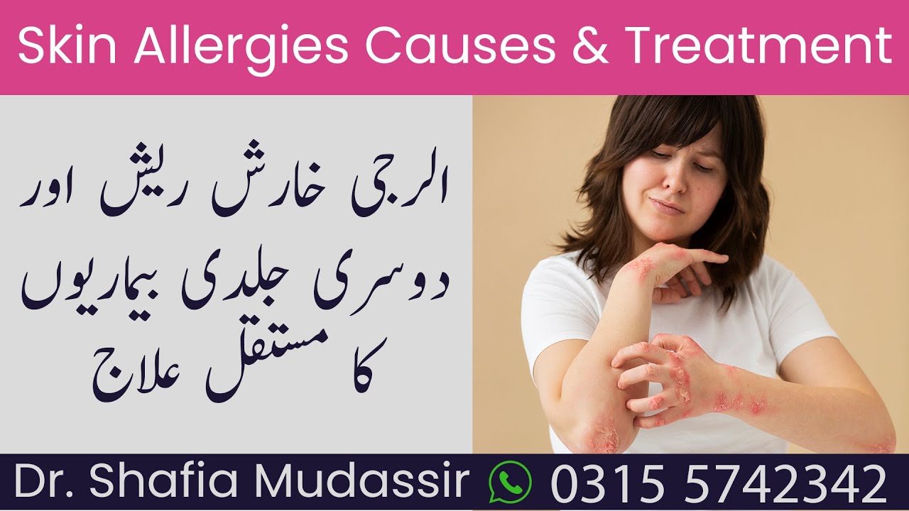 Pakistan Rash Skin Allergy Treatment in Rawalpindi | Best Skin Specialist | Symptoms ...