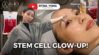 I Tried Kim Kardashian Style Stem Cell Therapy Tina Yong s Korean Glow-Up