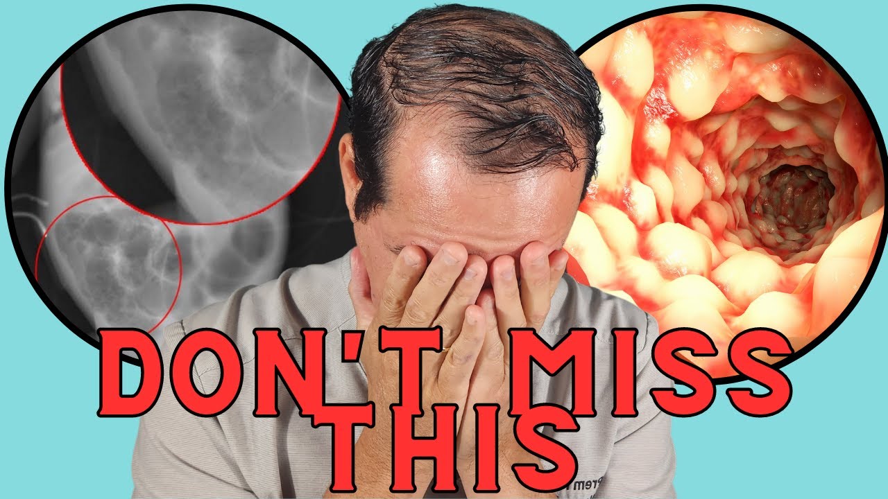 Важная информация для новичков в NEC: то, что вы упускали!