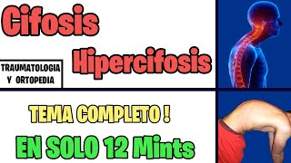 Cifosis HIPERCIFOSIS Cifosis Patológica  Mejor EXPLICADO 2022 | ORTOPEDIA
