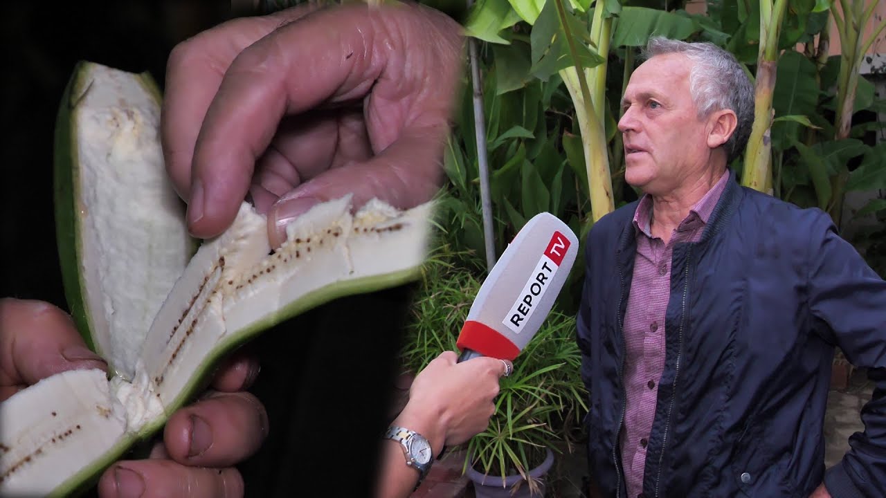 ‘Banania më shpëtoi jetën’ Përparim Agaçi, rrëfen sëmundjen e rrallë