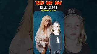 Billie Eilish: 6 to Now – Unbelievable Evolution! 🎶 #BillieEilish #ThenAndNow #BirdsOfAFeather Net Worth