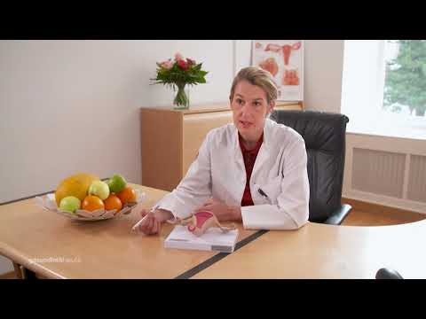 Video: Interstitielle Uterusmyome - Symptome, Ursachen Und Behandlung