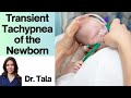 Transient tachypnea of the newborn  ttn  tala talks nicu