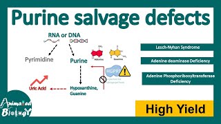 Purine Salvage Defects | Lesch-Nyhan Syndrome | Adenosine deaminase (ADA) deficiency