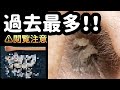 【耳掃除】#44 耳かき 〜最初から最後まで取れ高あり過ぎ〜 earwax