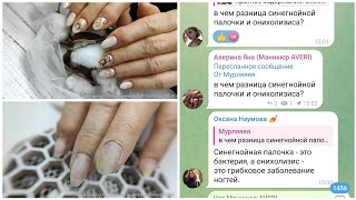 Новая клиентка с онихолизисом. Это синегнойка и грибок !