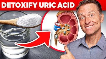 The Ultimate Kidney Cleanse for Uric Acid and Gout: Dr. Berg