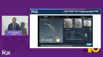The new global era of patient care with CathWorks FFRangio - EuroPCR 2025