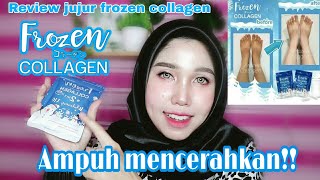 REVIEW JUJUR KAPSUL PEMUTIH  FROZEN COLLAGEN 2 IN 1 !!! ilma alimah