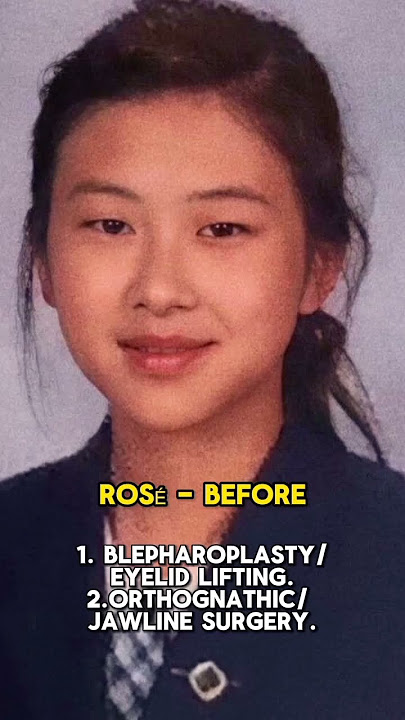 BLACKPINK MEMBERS PLASTIC SURGERIES! *NO HATE* #blackpink #plasticsurgery