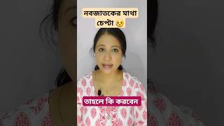 শিশুর মাথা চেপ্টা ? - তাহলে জেনে নিন কি করবেন bengalivlog viral bengaliyoutuber