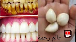 تبييض الاسنان في ثواني لن تلجأ لطبيب ولا لإزالة الجير سيسقط وحده بعد فرك السنانك بها