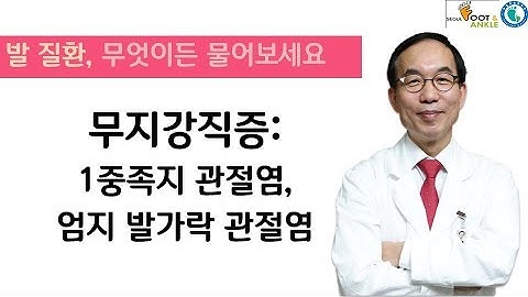 [발질환, 무엇이든 물어보세요] 엄지 관절염, 무지강직증