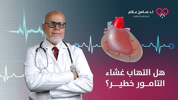 التامور هو غشاء يحيط بالقلب لكن هل التهاب غشاء التامور خطير؟ | دكتور سامح علام
