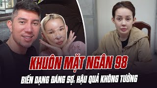 Khuôn Mặt Ngân 98 Biến Dạng Đáng Sợ Hậu Quả Để Lại Là Không Thể Tưởng Tượng Nổi
