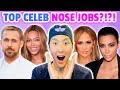 Plastic Surgeon Reveals The Top Five Best Celebrity Nose Jobs!