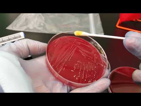 Microbiology: Translated Propionibacterium acnes biochemical testing & colonial growth