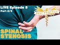 Neurosurgeon answers spinal stenosis can you get better without surgery nope
