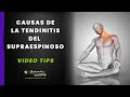 😓TENDINITIS DEL SUPRAESPINOSO😓 #5 Causas (MUY IMPORTANTES) a tener en cuenta en el DOLOR de HOMBRO