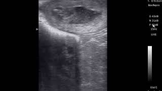 Bovine Fetal Anomalies—The Mummy