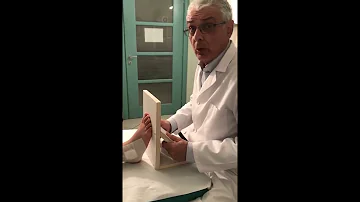Cosa vuol dire piede valgo?