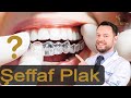 Şeffaf Plak (invisalign) Tedavisine Başlayacaklar için Pratik Bilgiler