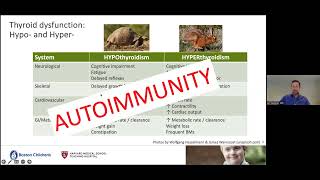 Close Connections in Autoimmunity: Thyroid Disorders and Celiac Disease