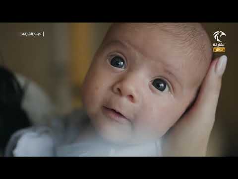 برنامج صباح الشارقة - حبوب الوجه عند الأطفال حديثي الولادة