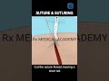 🧵 Suture & Suturing Procedure | Step-by-Step Clinical Skill