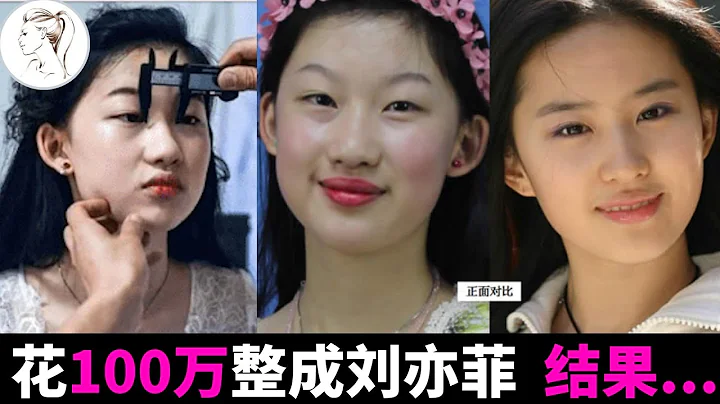 19岁少女花百万整容成“刘亦菲”，名字也高仿，6年后如今好吗？ - 天天要闻