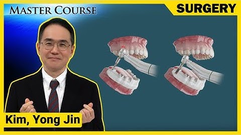 [Master Course Season2 - SURGERY] OneGuide template & printing