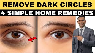 Remove Dark circle Permanently | How To Get Rid Of Dark Circles Naturally