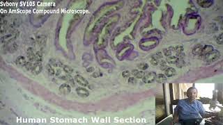 31- برنامج شرايح. الشريحة رقم 31. مقطع من جدار المعدة البشري. Human Stomach Wall Section