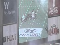 Ucla int for td