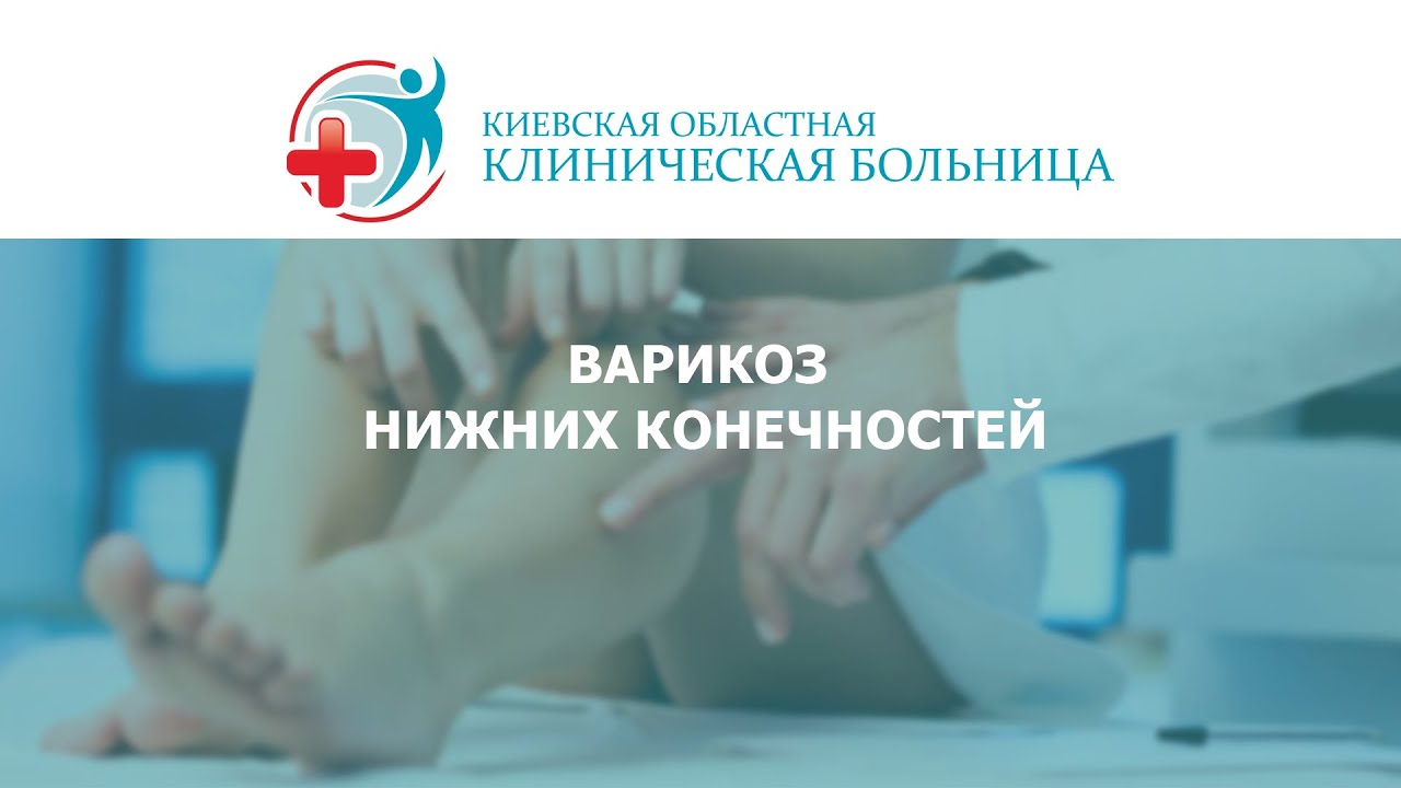 Операция варикоз нижних конечностей