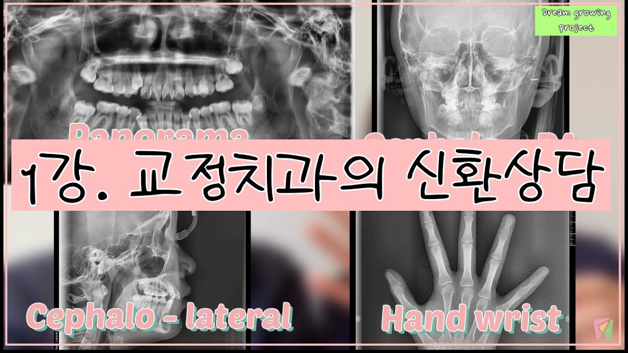 [★DREAM GROWING PROJECT★] 1 .엑스레이촬영ㅣ#alginate 본뜨기ㅣ얼굴사진 ㅣ입안사진ㅣ초보#치과위생사 교육영상
