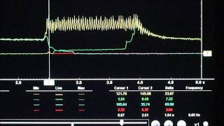 Aisian AW TCM Learn Procedure