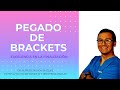 EXCELENCIA EN EL PEGADO DE BRACKETS