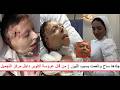  وجه العروسة ساح واتش   و هت قبل الفرح بسبب حرارة الليزر  ماذا حدث داخل عيادة التجميل  دندنها
