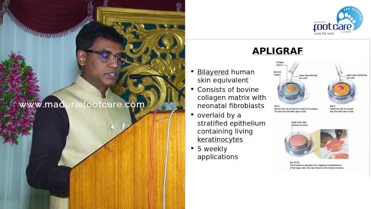 APLIGRAF Madurai Foot Care Centre Madurai YouTube