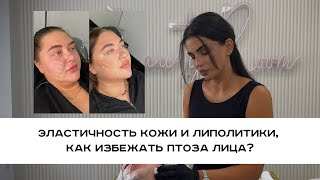 Этого не знают 90% косметологов и поэтому получают птоз лица и провалы!