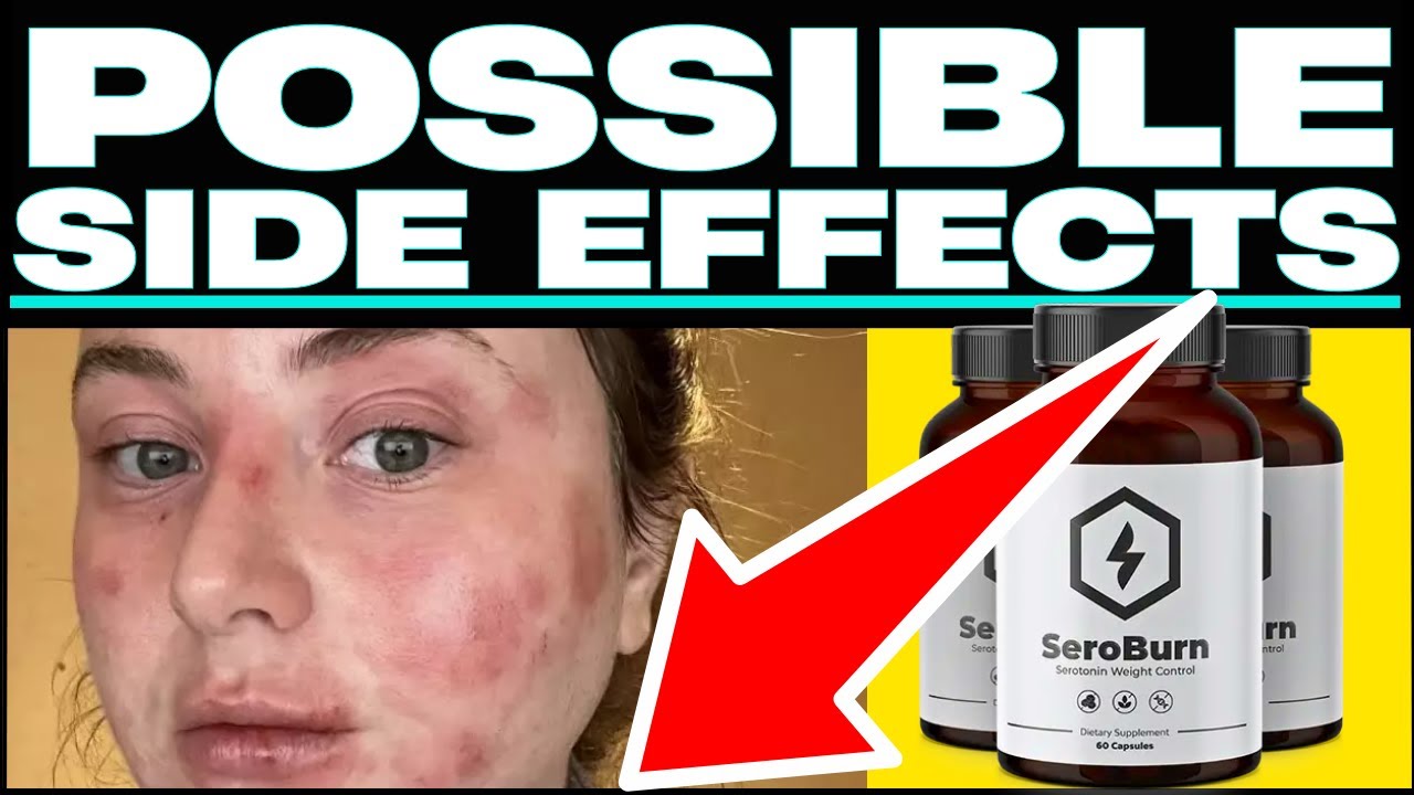 Lose weight fast? (😱❌BEWARE⛔🙀) Get Your FREE Bottle Of SeroBurn? @Seroburncom #seroburncom #seroburn