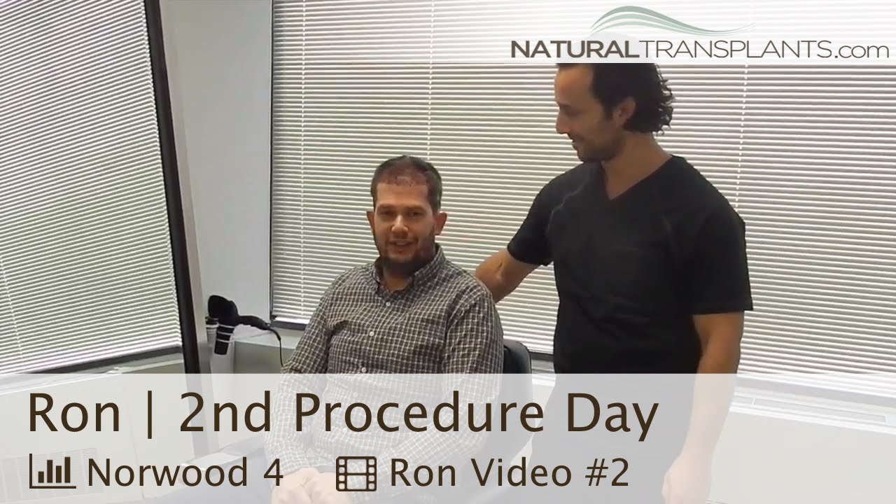 fue hair transplant month by month Hair Growth for Men Naturally | Hair Growth Treatment with Dr Kevin Blumenthal (Ron)